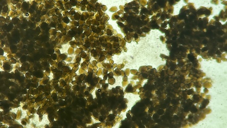 Egg Yolk
